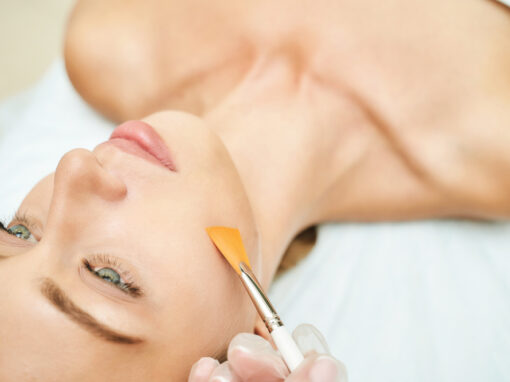 Peeling químico: todo lo que necesitas saber