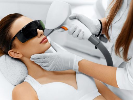 Cuidado facial después de una sesión de depilación láser